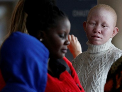 A Tanzanian woman with albinism visiting the U.S. for medical care, arrives at JFK International Airport in New York City, U.S., March 25, 2017. REUTERS/Brendan McDermid